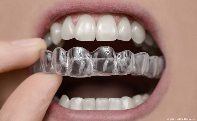 Zahnschiene gegen Zähneknirschen und Kiefergelenk-Knacken