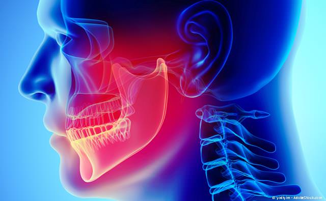 Ein falscher Biss kann Kiefergelenksprobleme verursachen