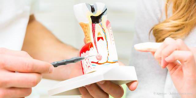 Tote Zähne können Störfelder sein