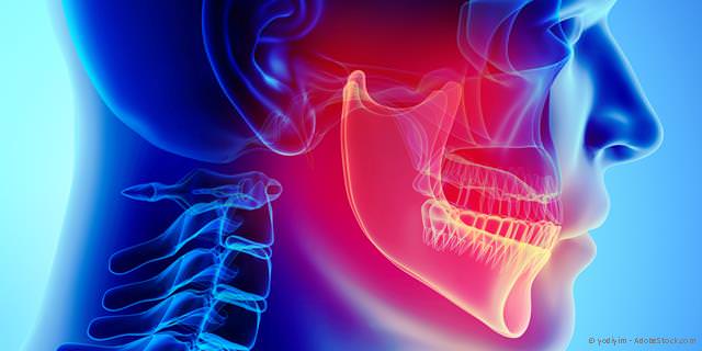 Computergestützte Kiefergelenksdiagnostik